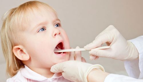 Mal di gola nei bambini