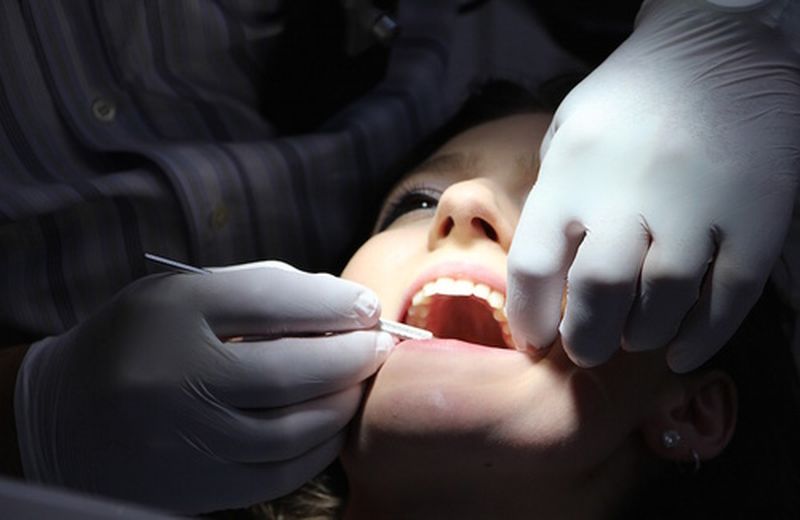 Amalgama per i denti: può essere dannosa per la salute?