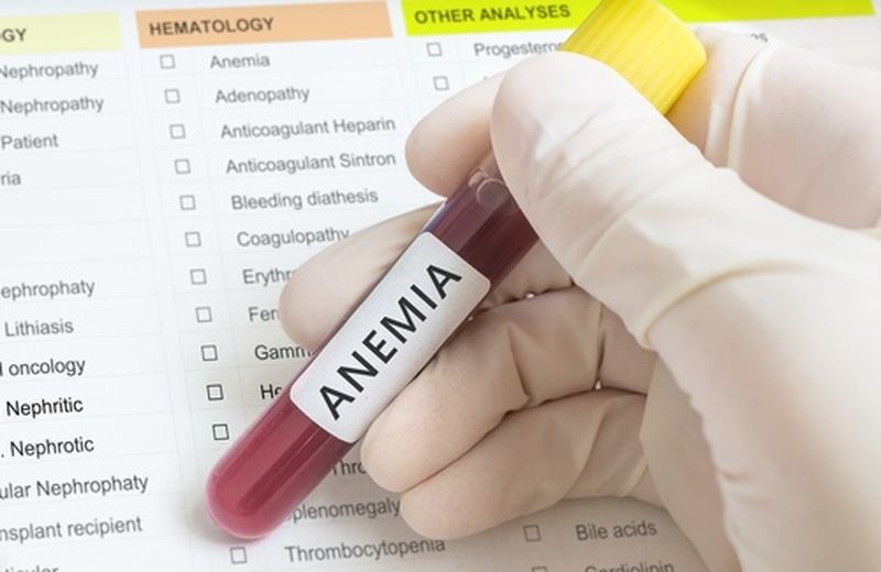 Anemia, le conseguenze per la salute