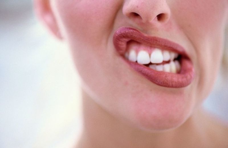 Afte della bocca, come prevenirle